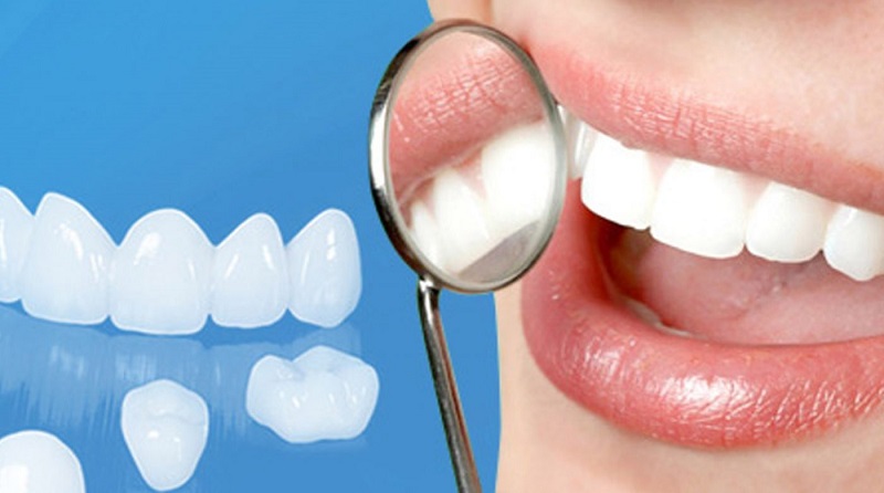 Bọc răng sứ là phương pháp phải cải thiện khuyết điểm về răng hàng đầu