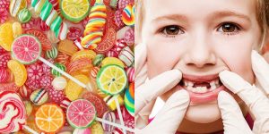 Kẹo ngọt chính là nguyên nhân dẫn đến sâu răng ở trẻ em