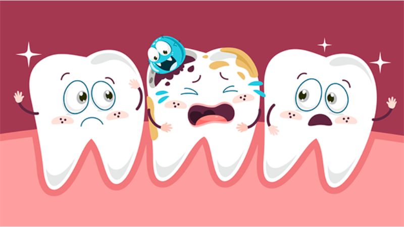 Sâu răng rất dễ lây lan từ răng này sang răng khác